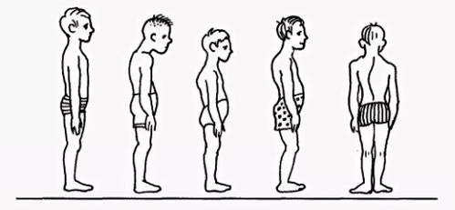 Violation de la posture