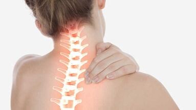 Les principales manifestations de l'ostéochondose cervicale