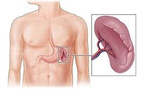 pathologie de la rate comme cause de douleur sous l'omoplate gauche