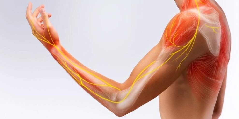 La douleur et l'engourdissement des doigts indiquent des dommages aux ligaments dus à une ligamentite sténosante.